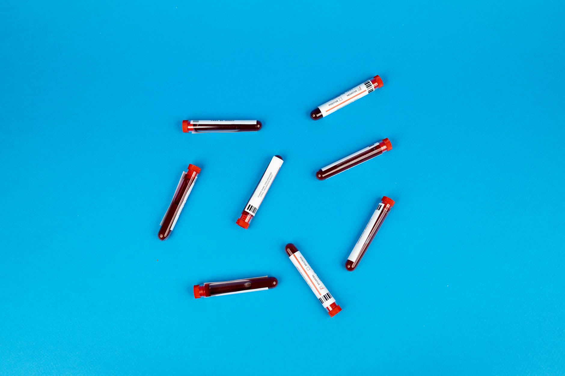 Multiple blood sample tubes arranged on a vivid blue background.