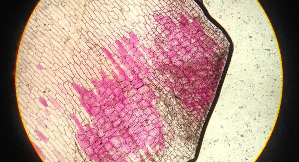 Close-up of stained plant cells in onion root under microscope.